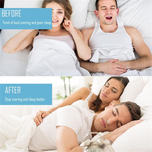 Anti - Ronflement Set De 4 Pièces Silicone Magnétique Nasal Clip Anti - Ronflement Solution Hommes Femmes Anti - Ronflement